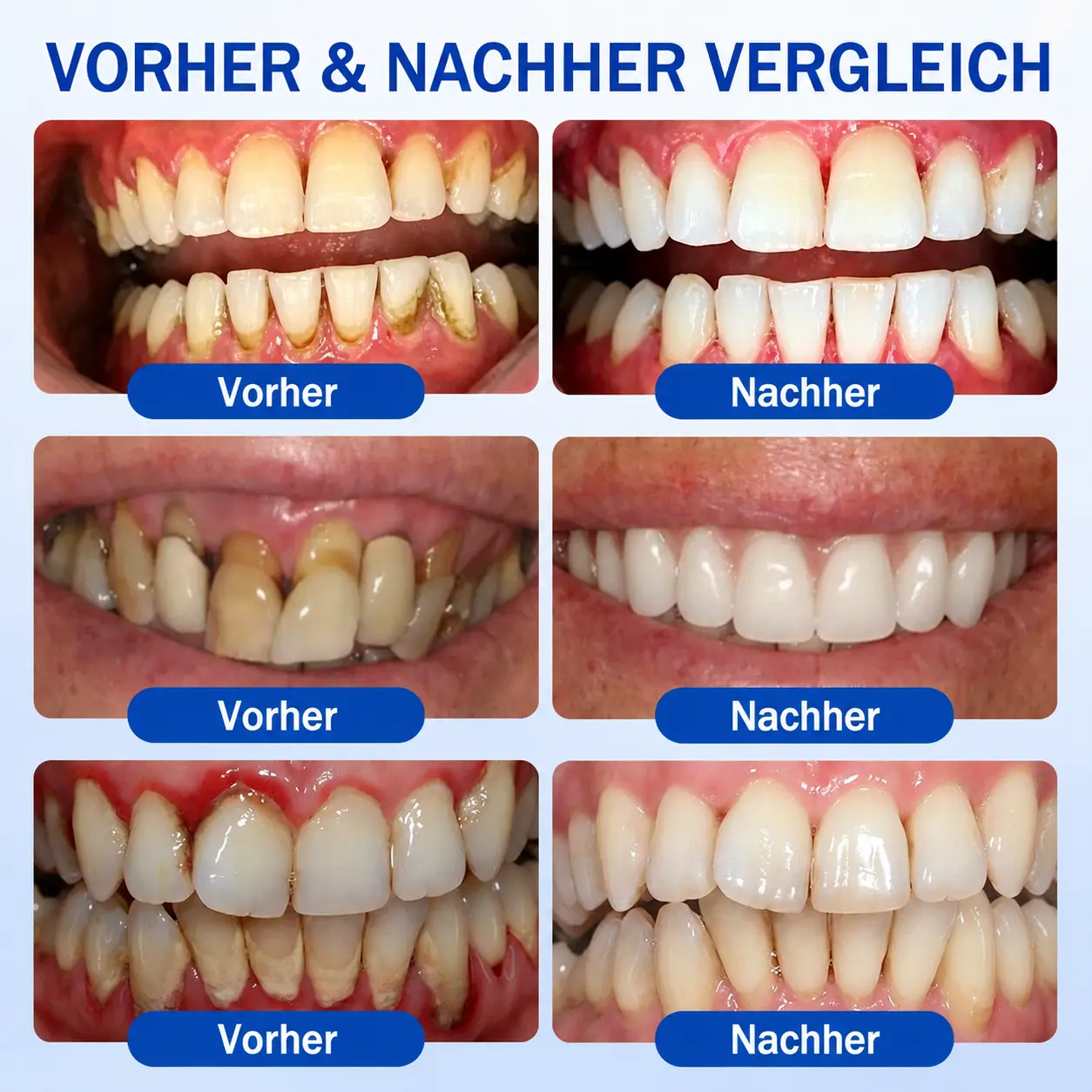 GumCare Pro | Zahnfleischpflege & Parodontal Gel - Image 3