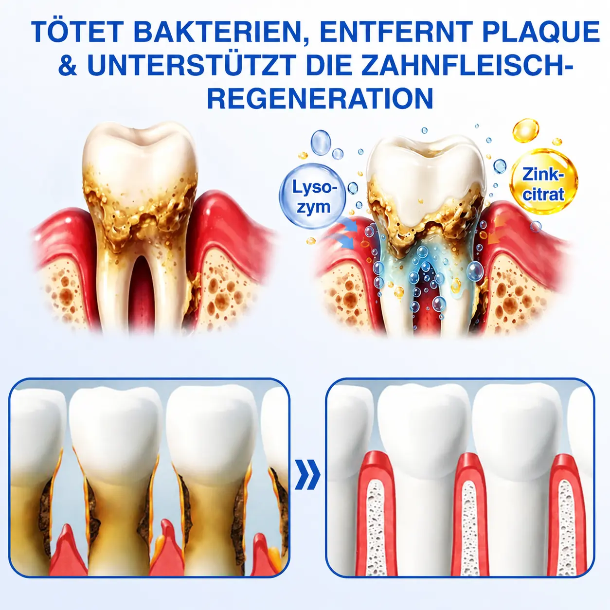 GumCare Pro | Zahnfleischpflege & Parodontal Gel - Image 7