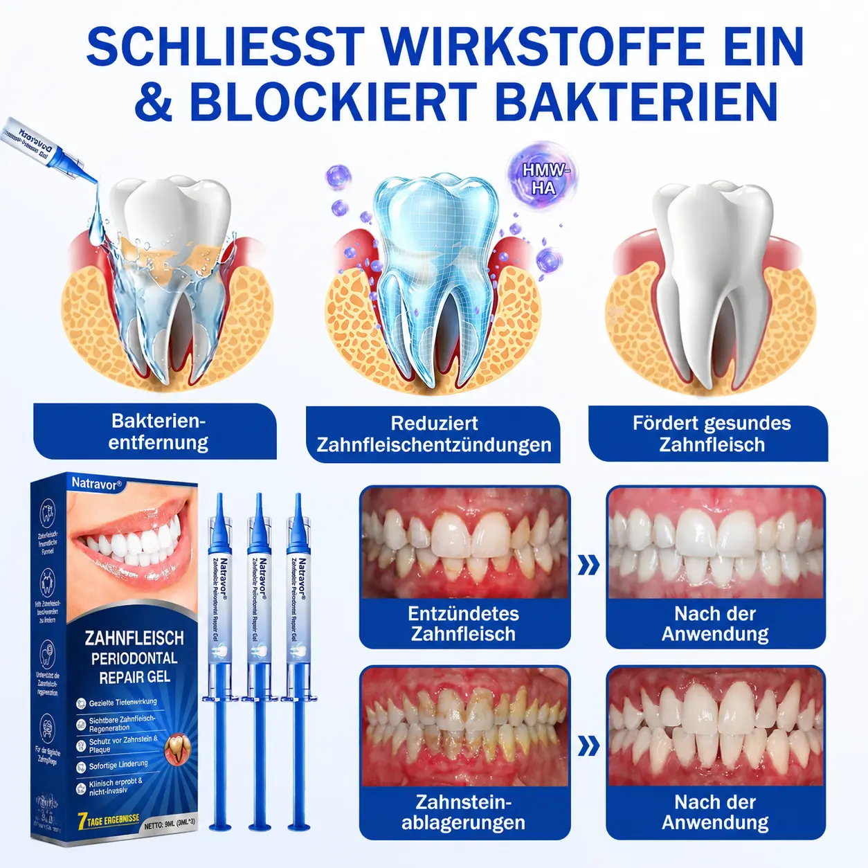 GumCare Pro | Zahnfleischpflege & Parodontal Gel - Image 9