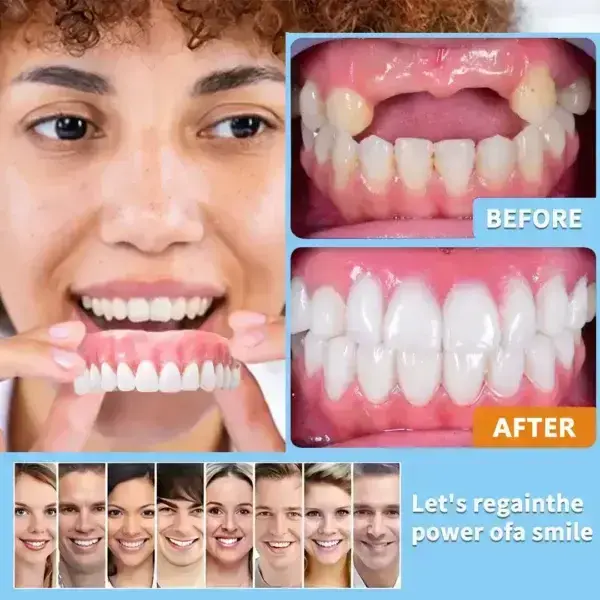 【Official Brand Store】Custom-Fit Functional Dentures — ComfortMax Edition - Image 6