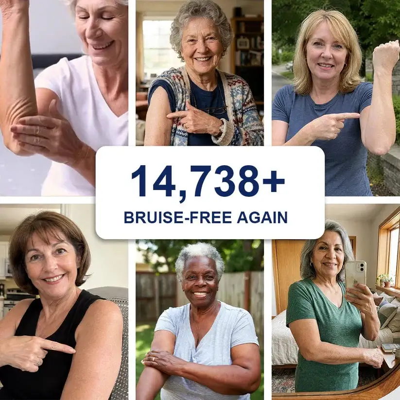 🏆Official US Bruise Repair & Skin-Strengthening Cream - Image 3