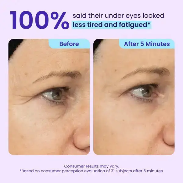 Eye Bag Instant Eraser - Image 2
