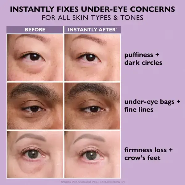 Eye Bag Instant Eraser - Image 9