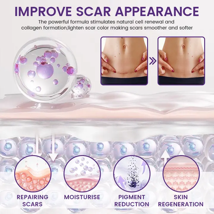 Stem Cell Scar Gel | Silicone Scar Care Gel for Old & New Scars - Image 4
