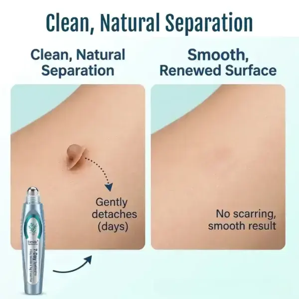 SpotlessPro Advanced Skin Care Pen - Image 7