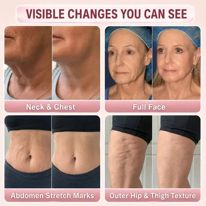 Facility Botox-Inspired Pure Collagen Firming Wand - Image 3