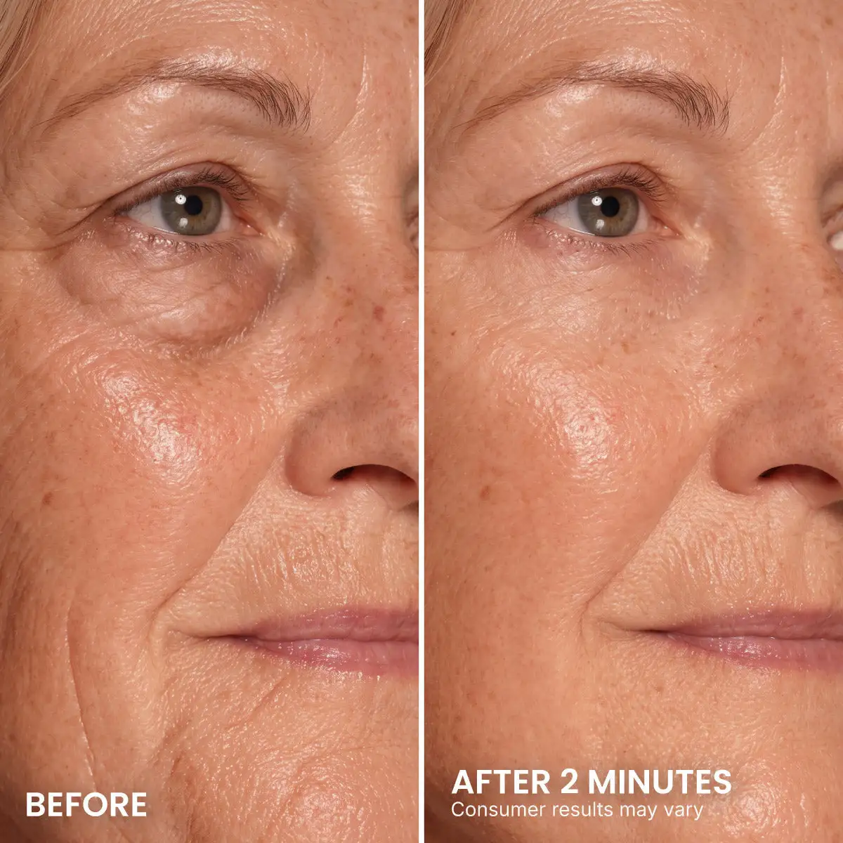 Instant Eye Tightener - Image 11