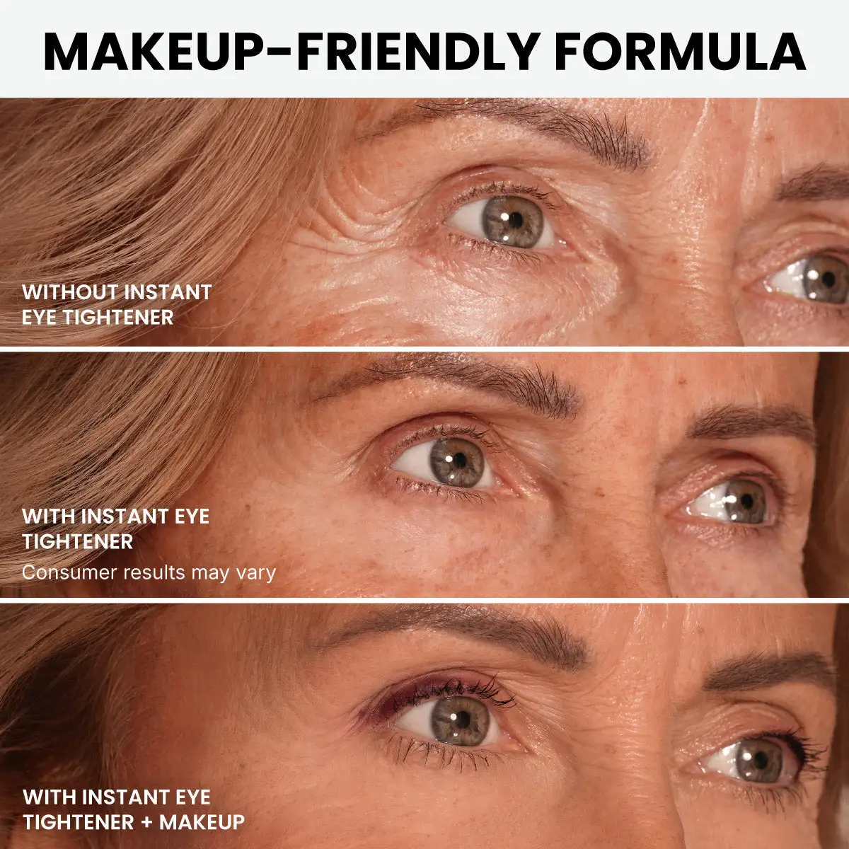 Instant Eye Tightener - Image 12