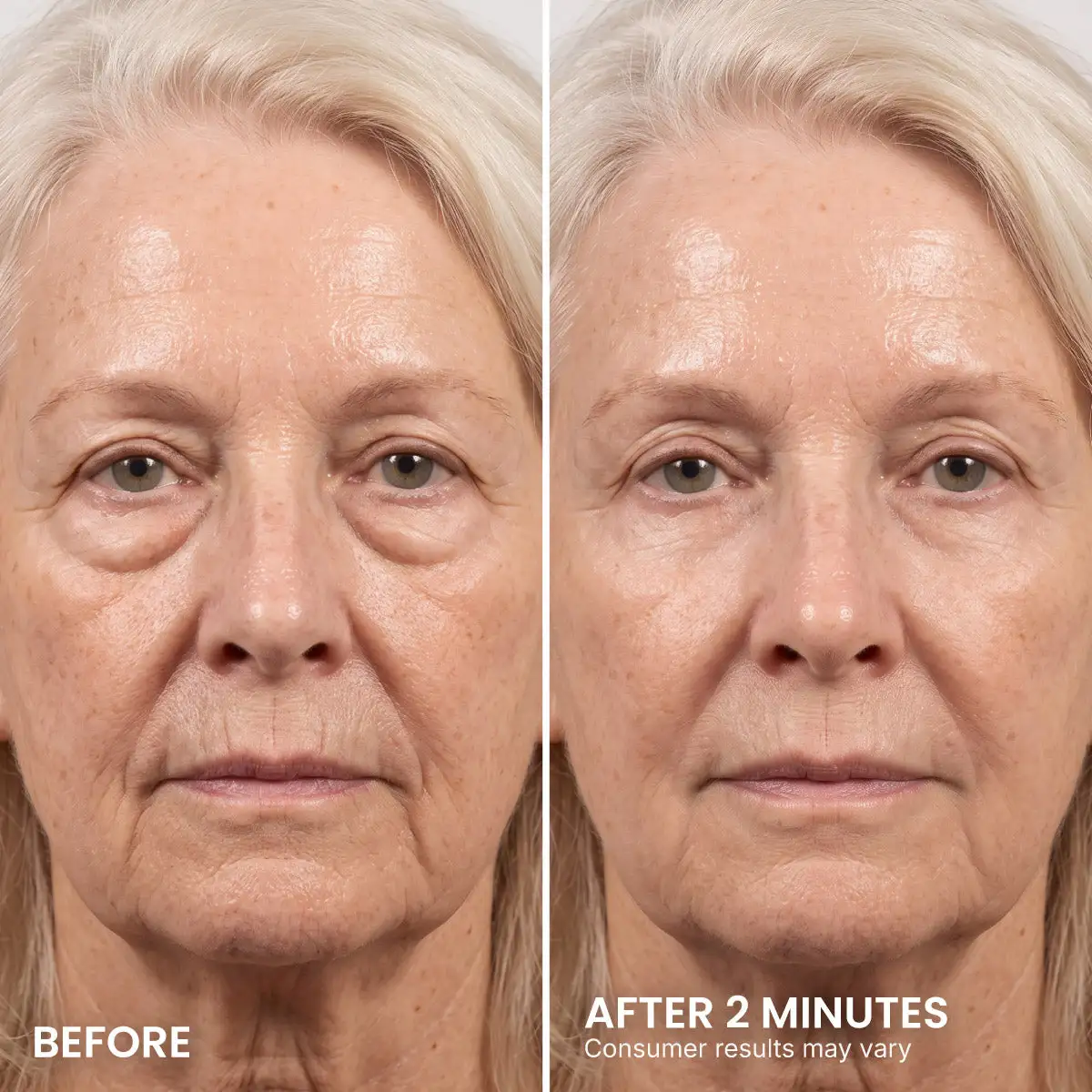 Instant Eye Tightener - Image 2