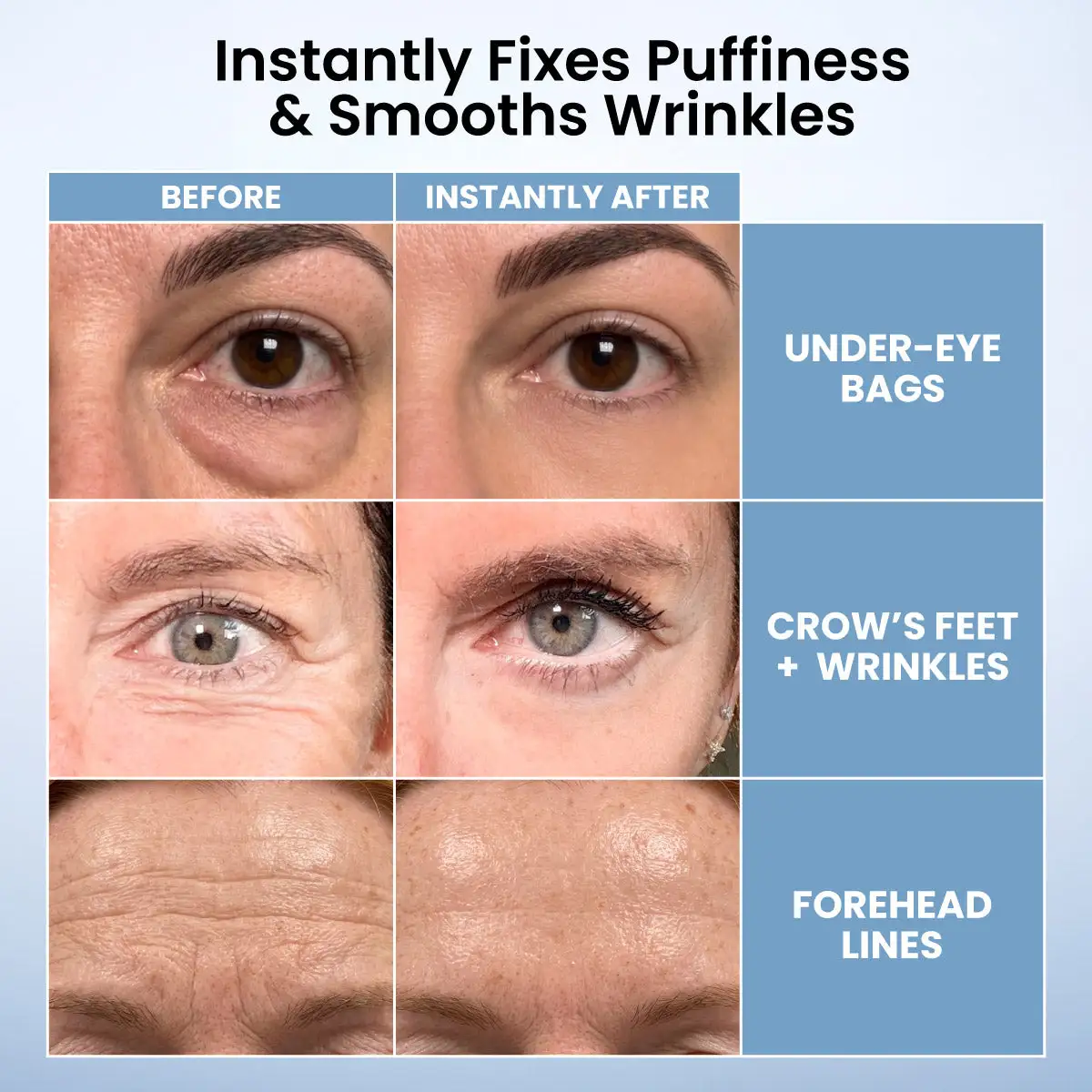 Instant Eye Tightener - Image 4
