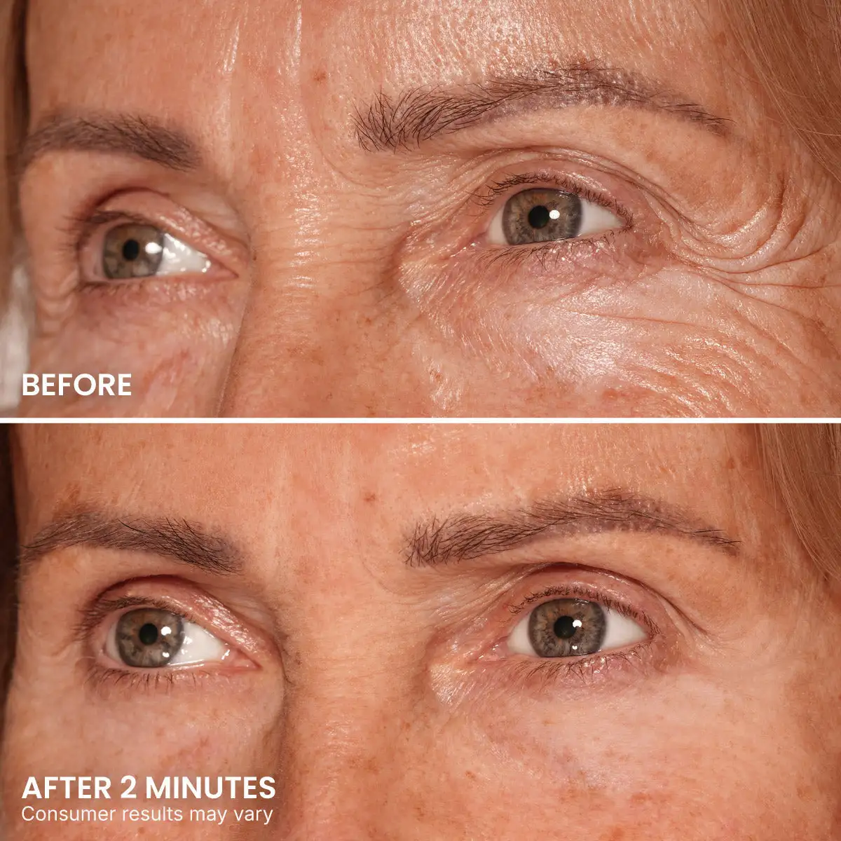 Instant Eye Tightener - Image 5