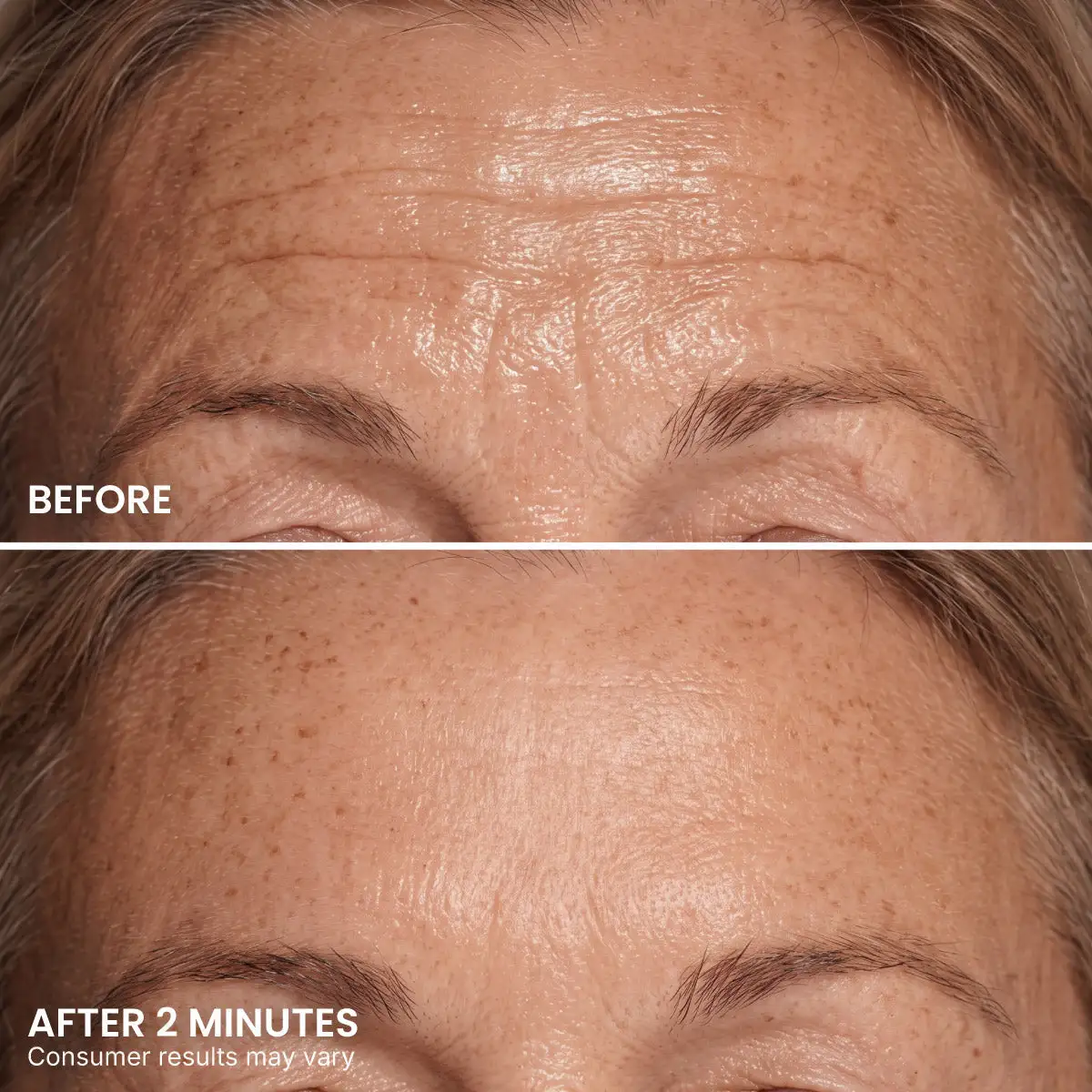 Instant Eye Tightener - Image 6