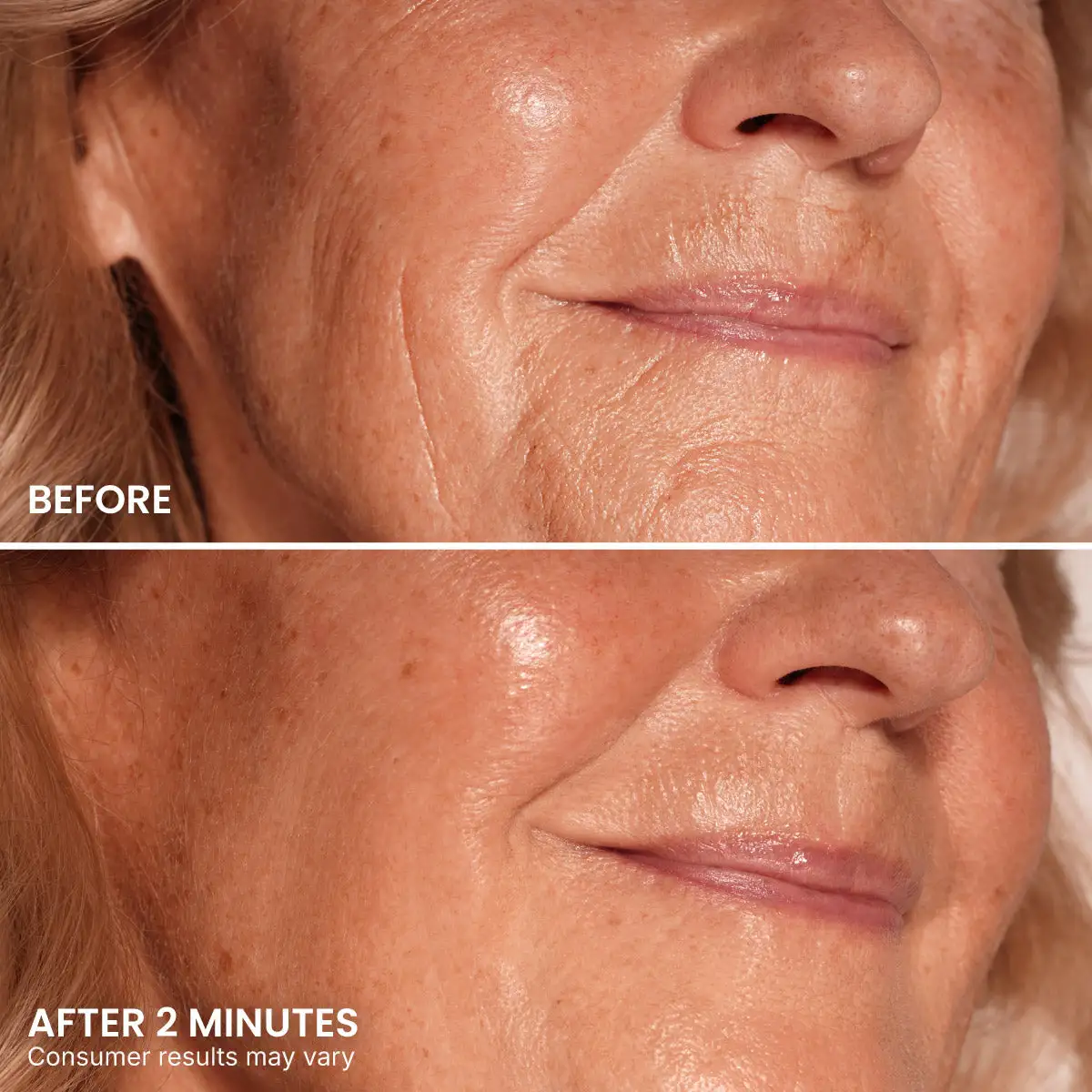 Instant Eye Tightener - Image 7