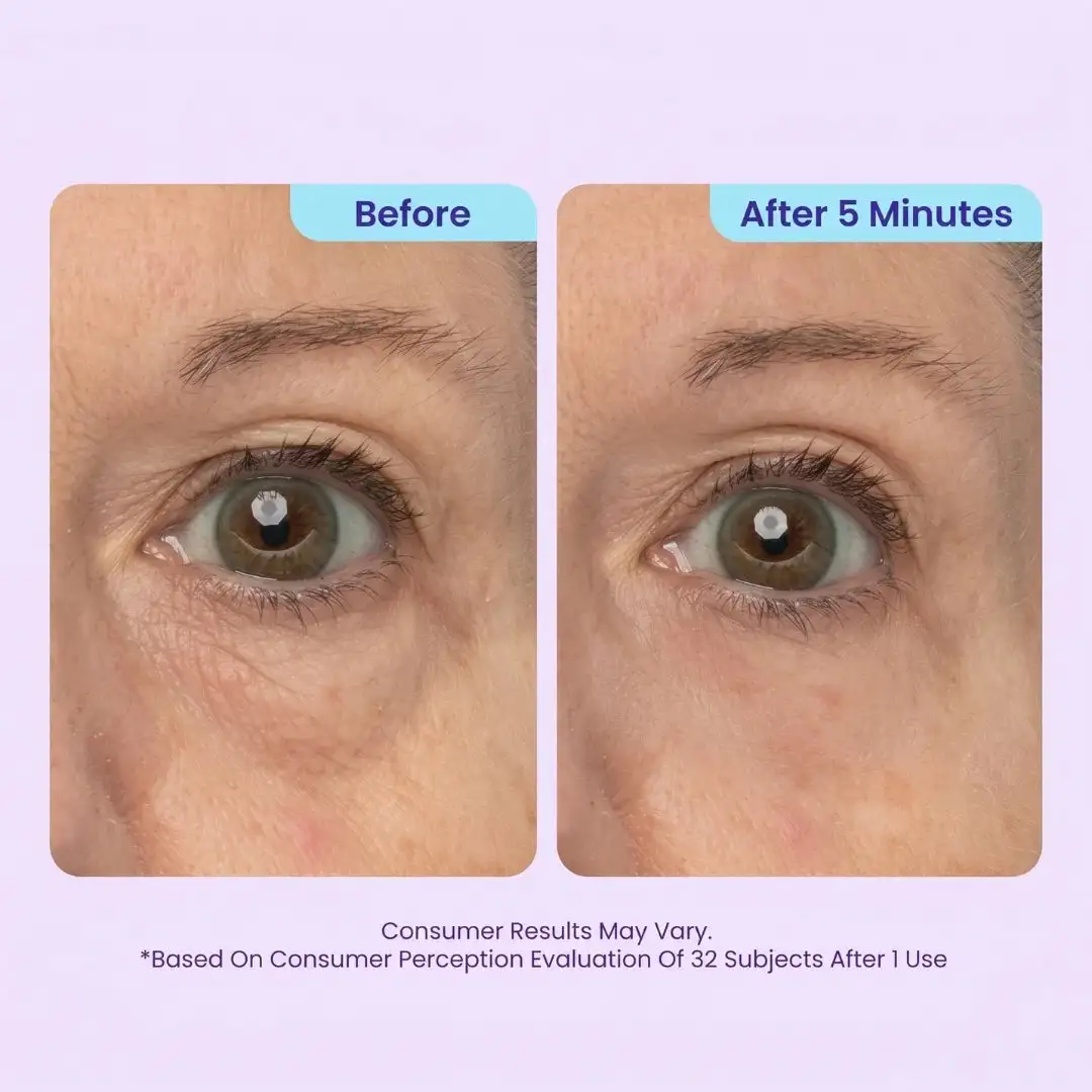 Instant Lift Eye Gel - Image 3
