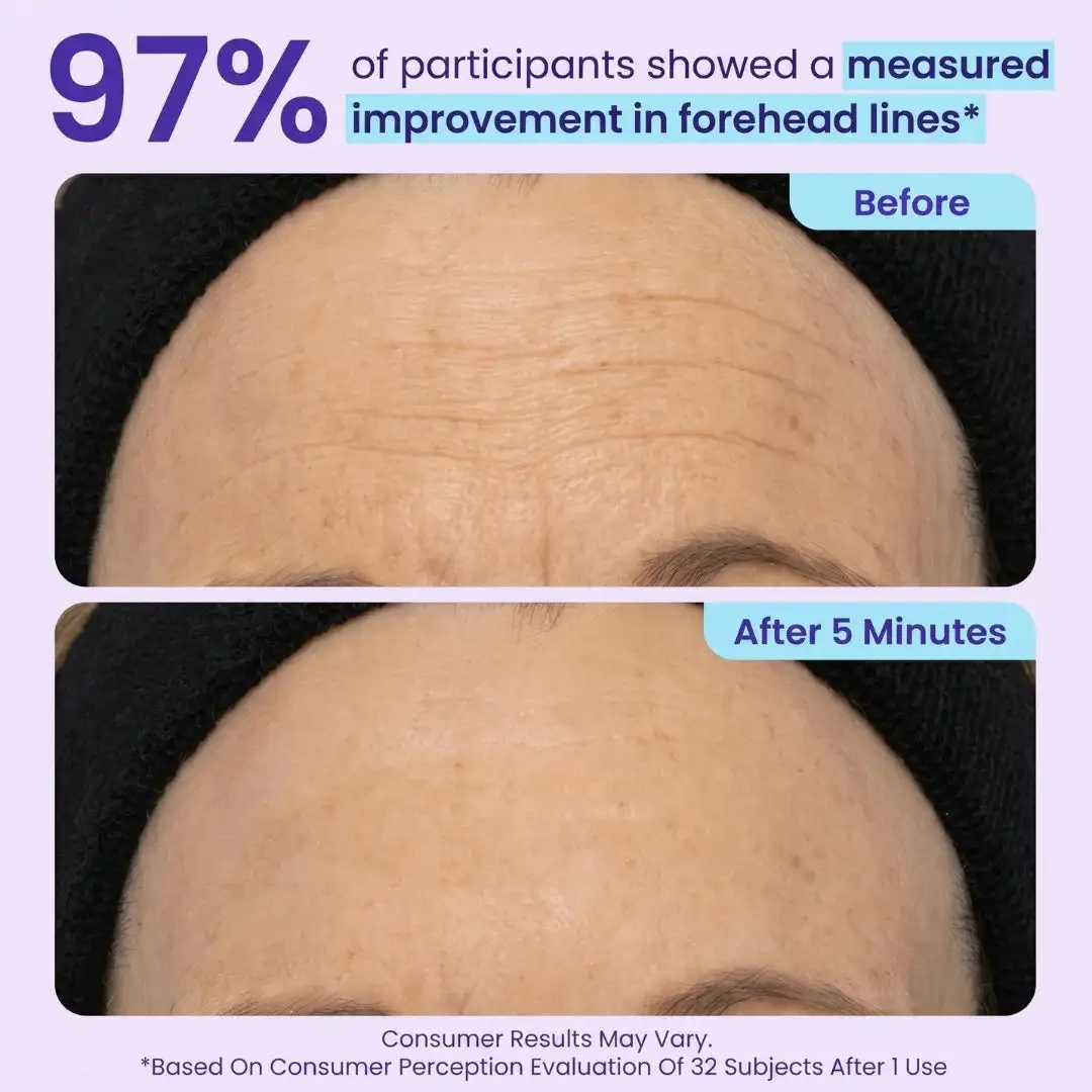 Instant Lift Eye Gel - Image 4