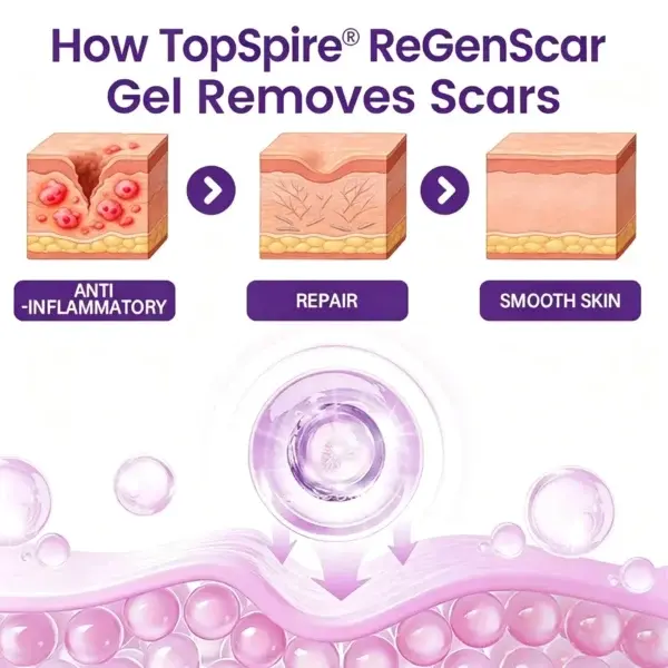 ReGenScar Stem Cell Scar Gel - Image 2