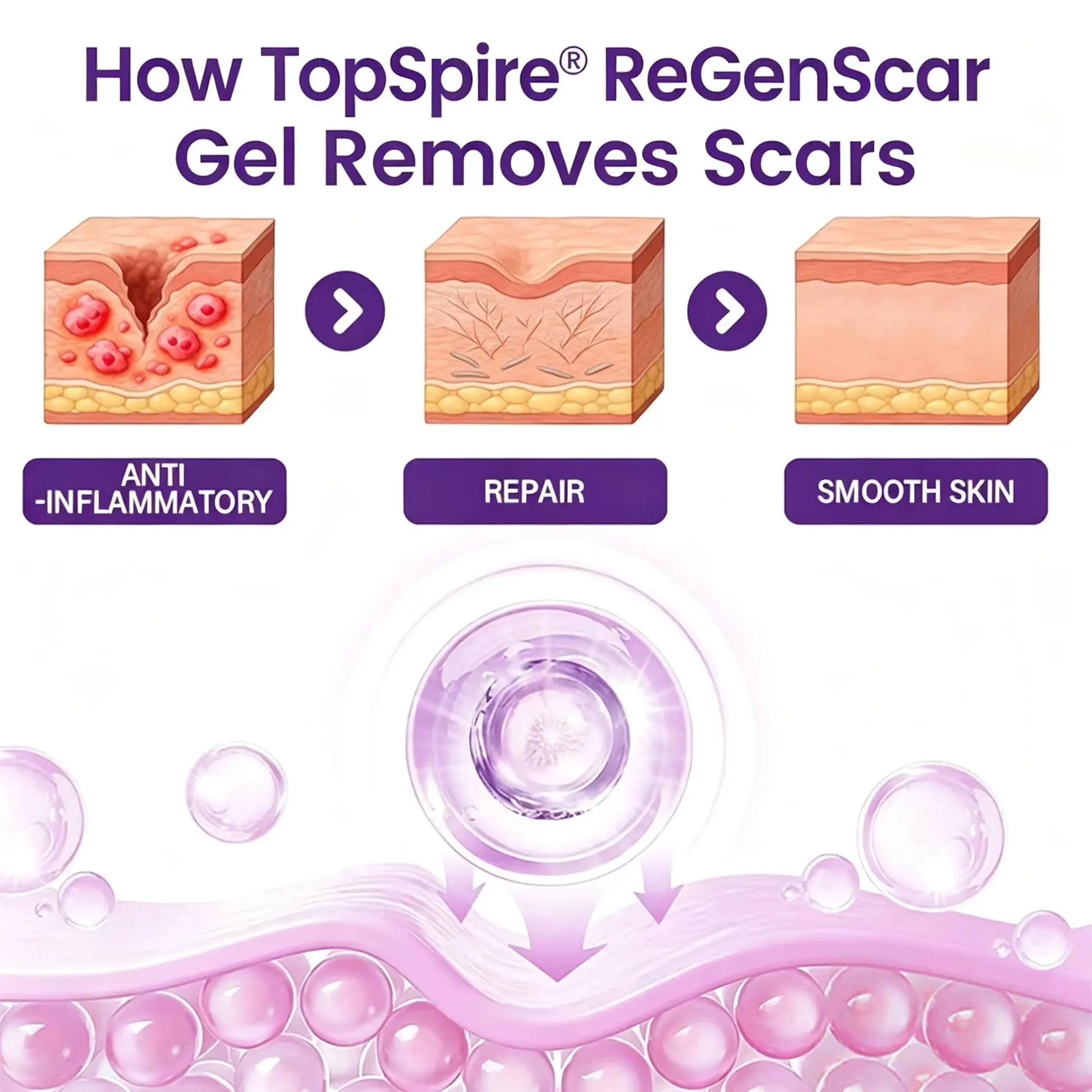 ReGenScar Stem Cell Scar Gel - Image 4