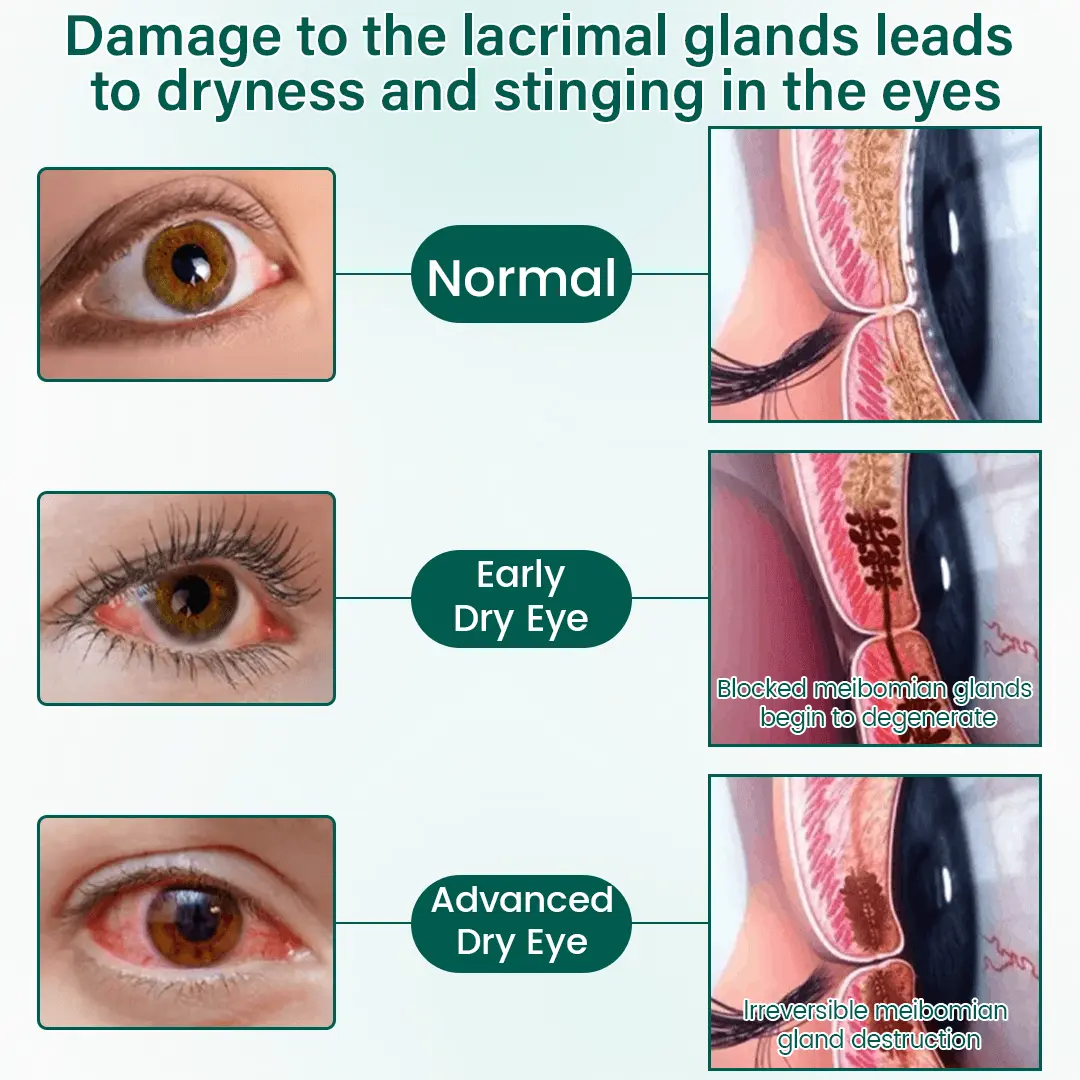 OptiClear Nano Eye Roller Serum - Image 7