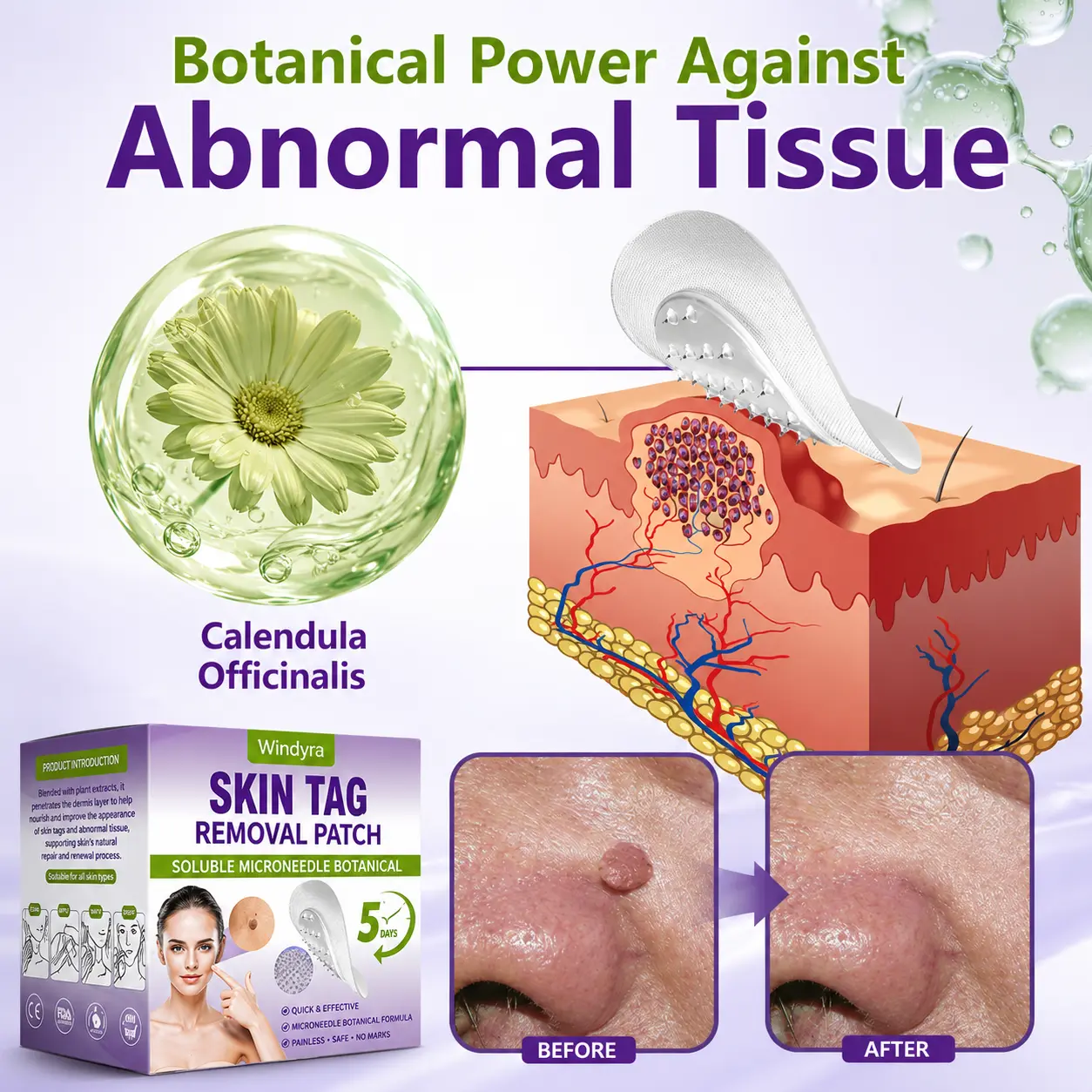 Soluble Microneedle Botanical Skin Tag Removal Patch - Image 13