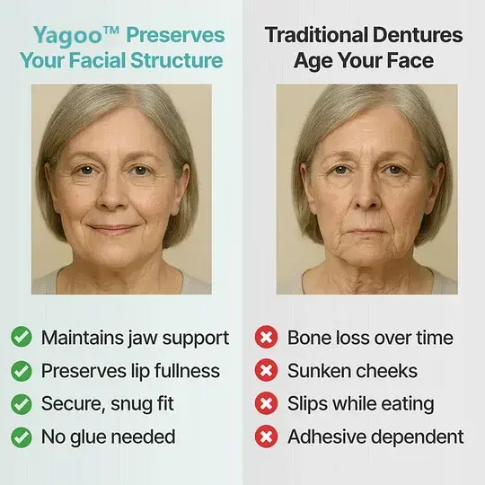 Custom Custom-Fit Full Functional Dentures - Image 8