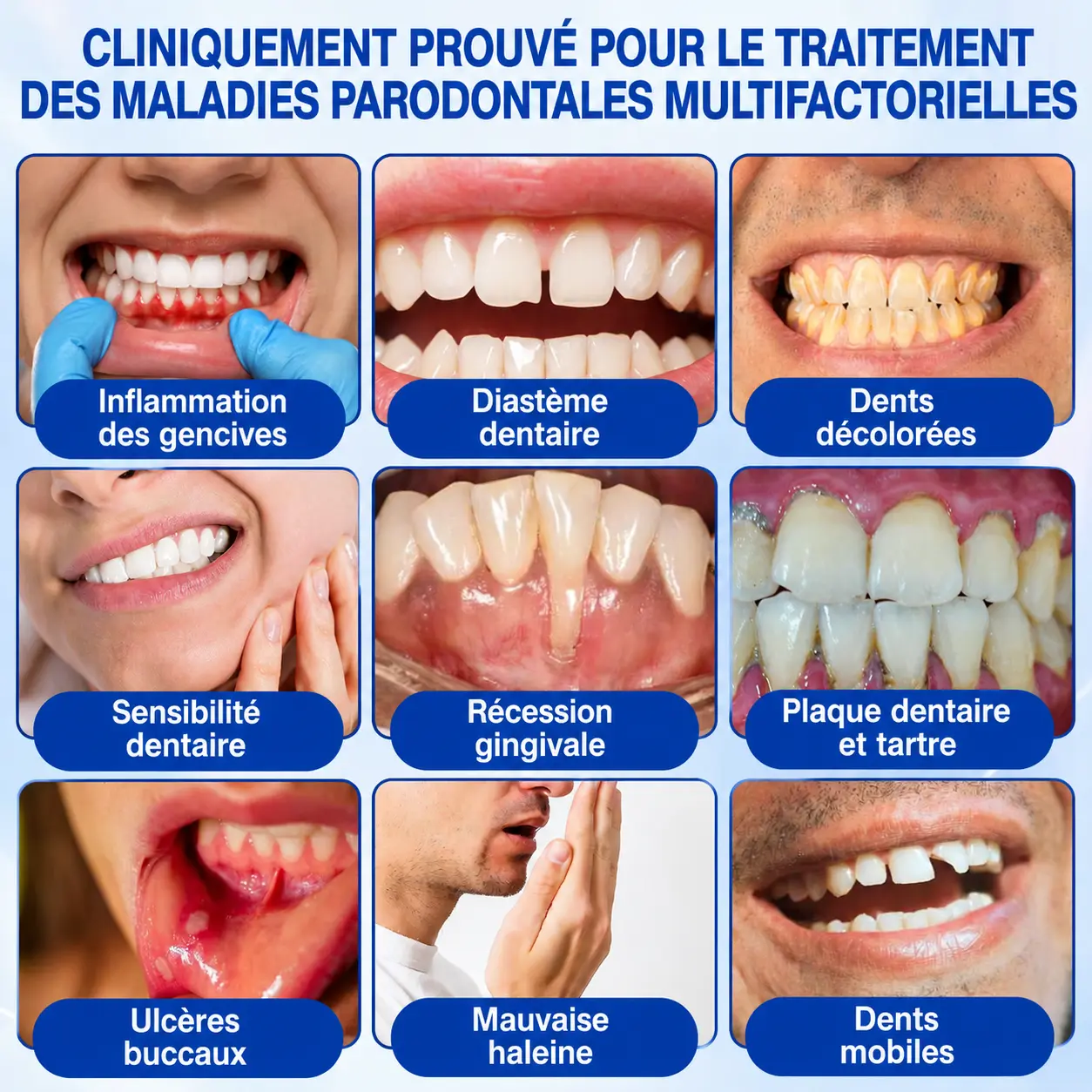 🦷 𝑮𝒖𝒎𝑹𝒆𝒗𝒊𝒗𝒆 𝑮𝒆𝒍 𝒅𝒆 𝑹é𝒑𝒂𝒓𝒂𝒕𝒊𝒐𝒏 𝑷𝒂𝒓𝒐𝒅𝒐𝒏𝒕𝒂𝒍𝒆 - Image 6