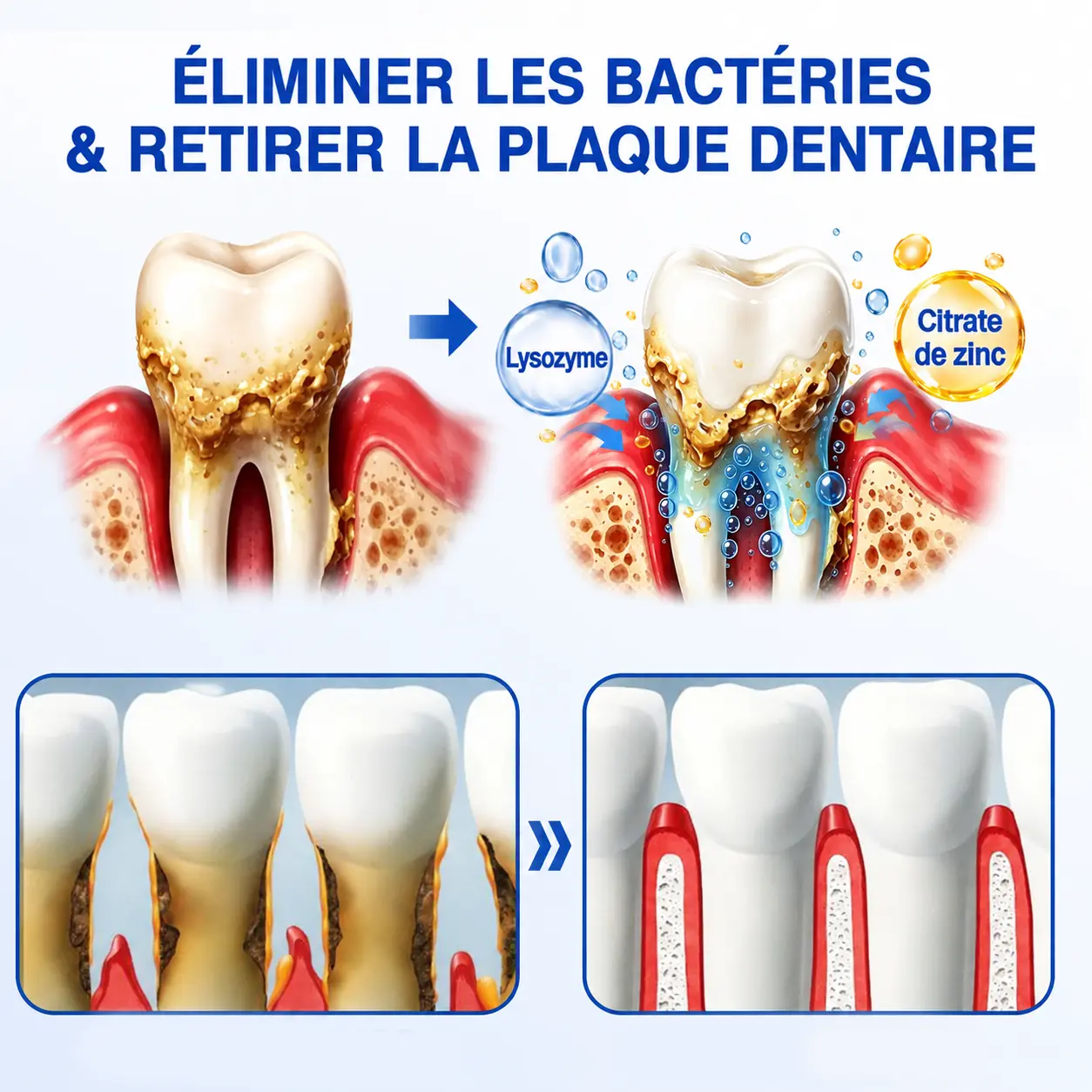 🦷 𝑮𝒖𝒎𝑹𝒆𝒗𝒊𝒗𝒆 𝑮𝒆𝒍 𝒅𝒆 𝑹é𝒑𝒂𝒓𝒂𝒕𝒊𝒐𝒏 𝑷𝒂𝒓𝒐𝒅𝒐𝒏𝒕𝒂𝒍𝒆 - Image 8