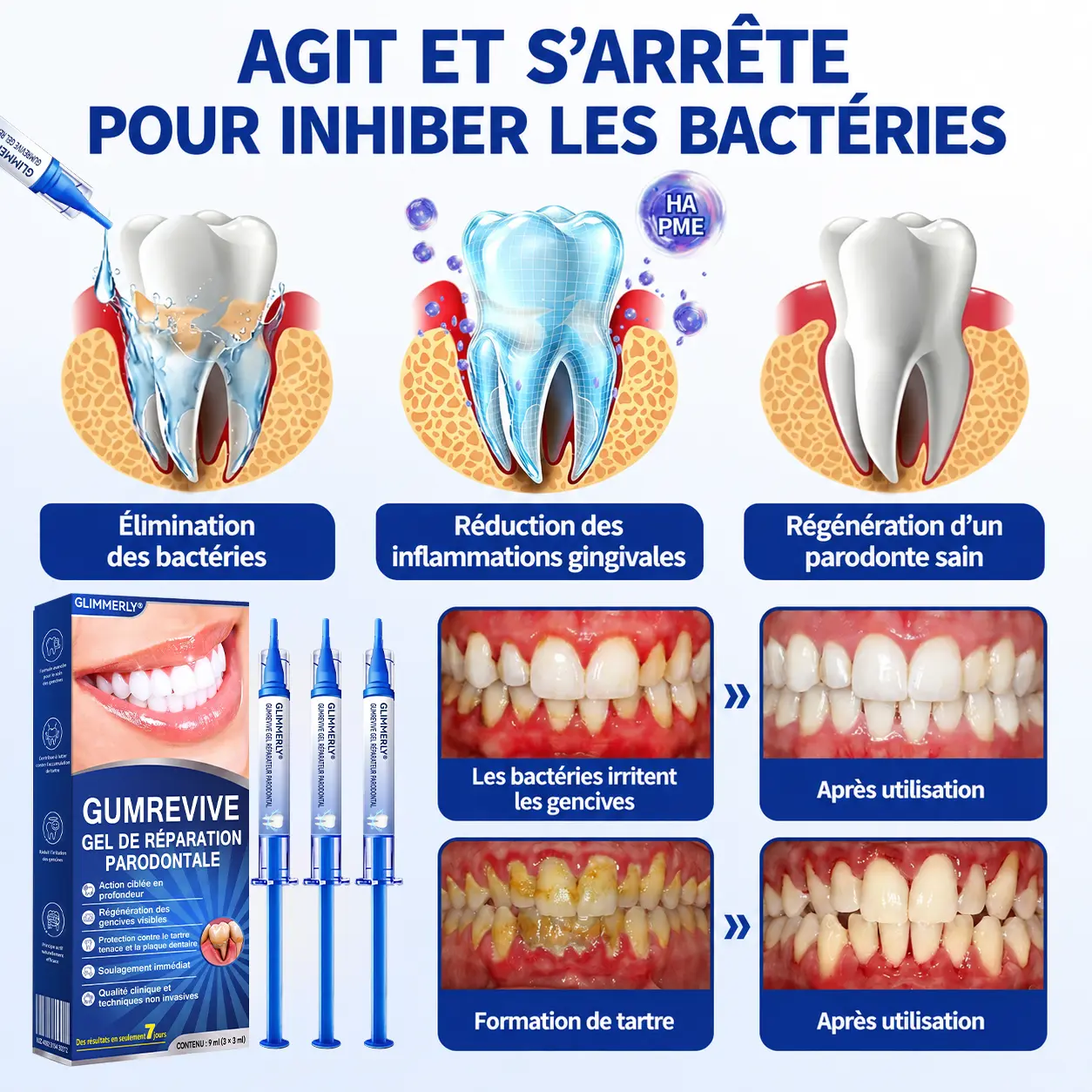 🦷 𝑮𝒖𝒎𝑹𝒆𝒗𝒊𝒗𝒆 𝑮𝒆𝒍 𝒅𝒆 𝑹é𝒑𝒂𝒓𝒂𝒕𝒊𝒐𝒏 𝑷𝒂𝒓𝒐𝒅𝒐𝒏𝒕𝒂𝒍𝒆 - Image 9