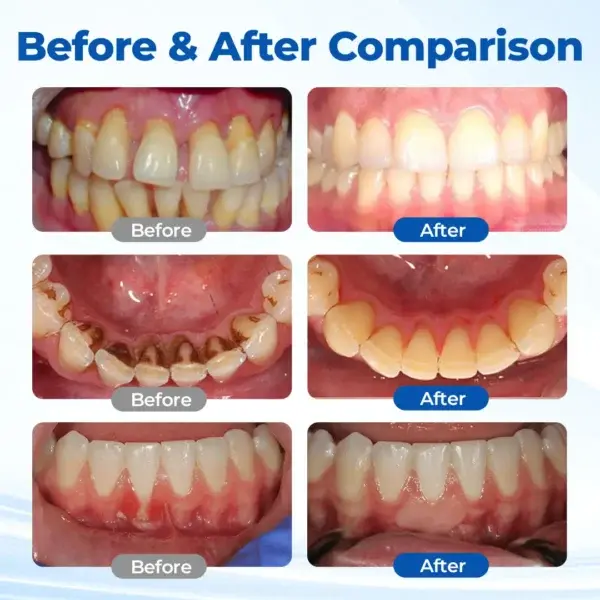 GumBiome Recovery Gel - Image 3