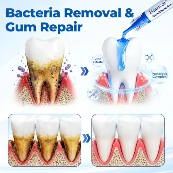GumBiome Recovery Gel - Image 4