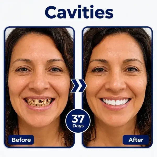 GumRevive Advanced Gum Care Gel - Image 2