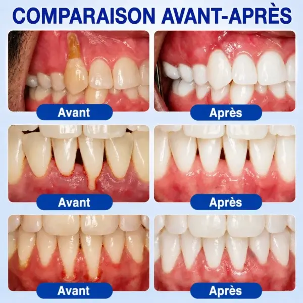 Gel Parodontal - Image 13