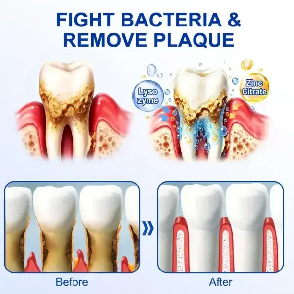 Periodontal Gel - Image 14