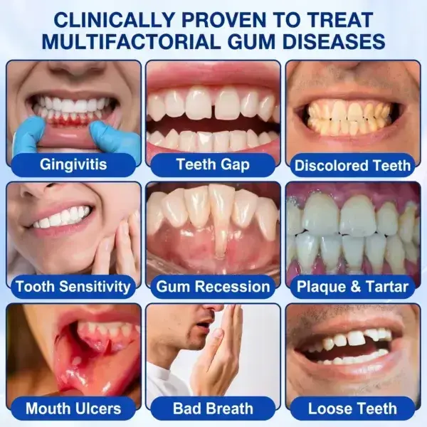 Periodontal Gel - Image 3