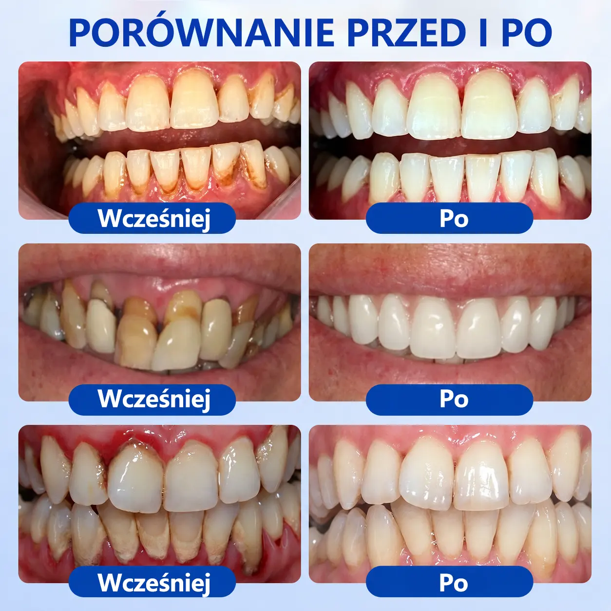 GumRevive - Image 7