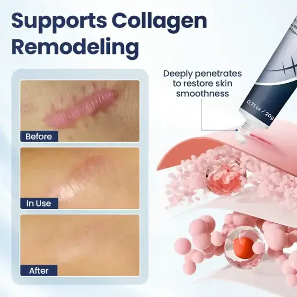 Texture Repair Gel - Image 4