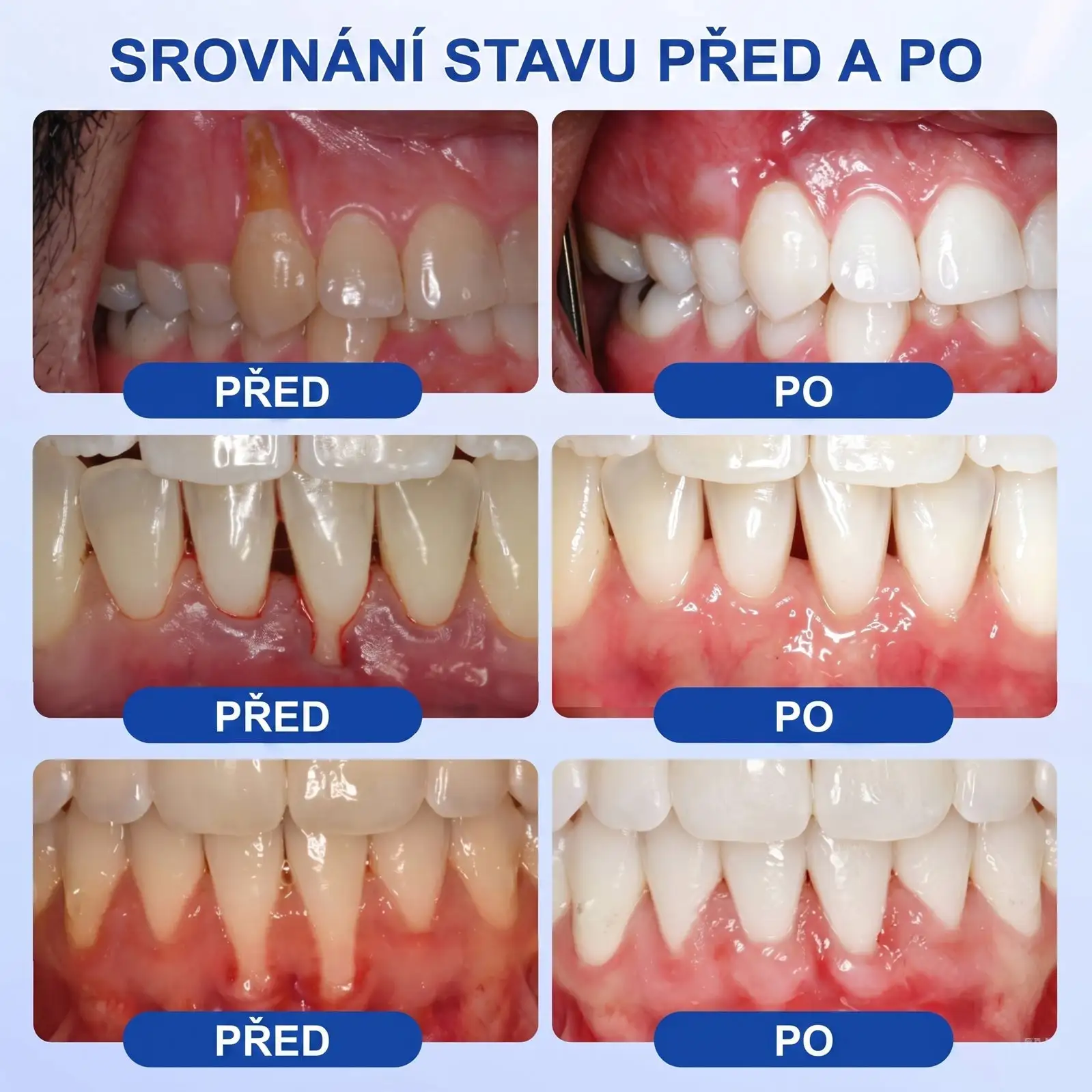 GumRevive - Image 3