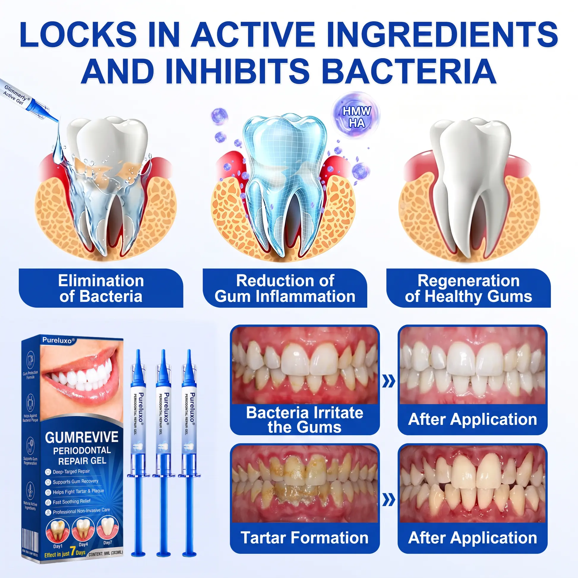 GumRevive Periodontal Repair Gel - Image 9