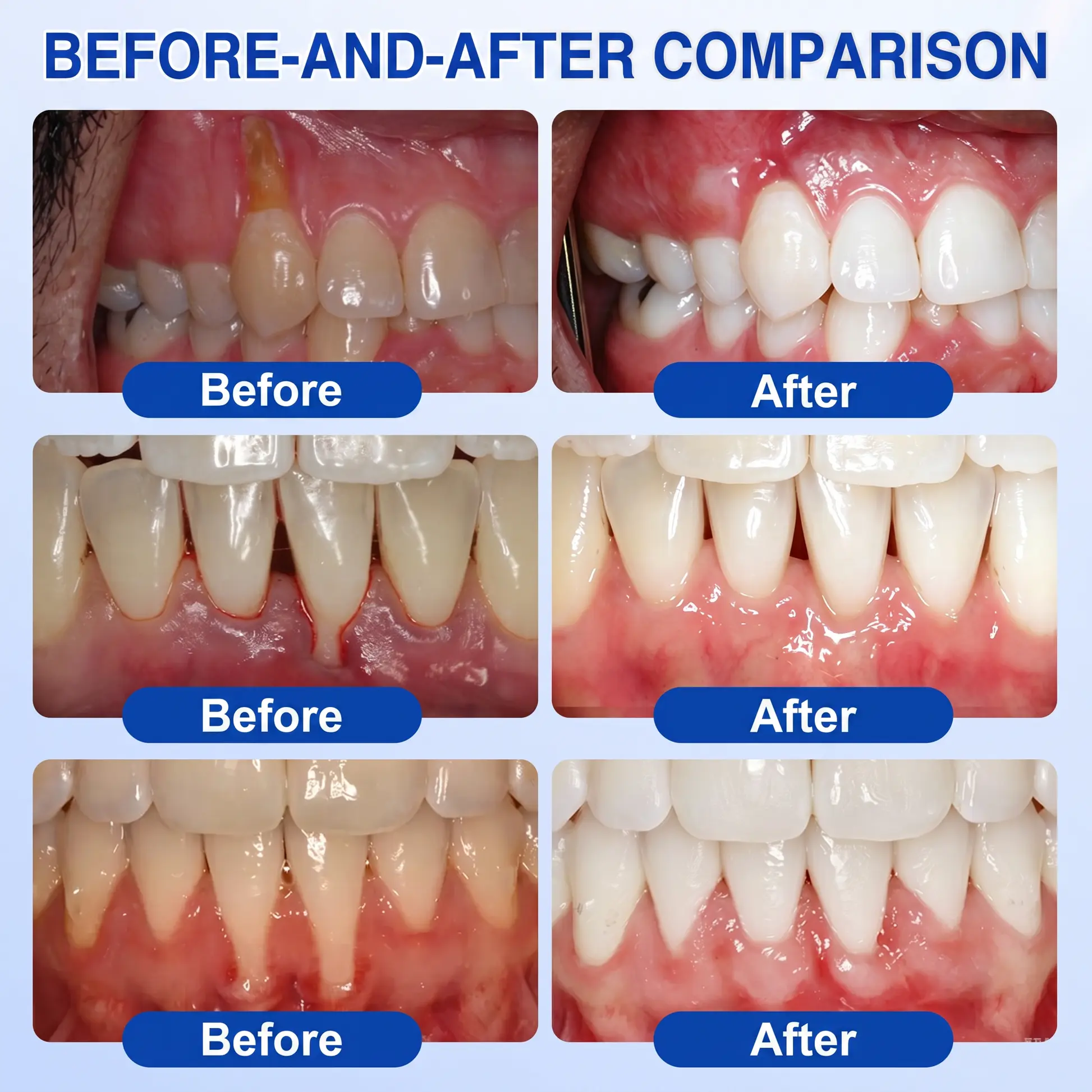 Gum Revive - Image 2