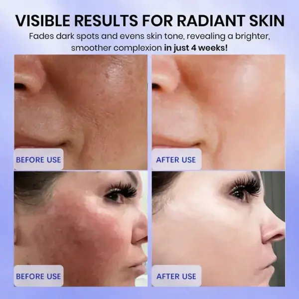 Radiglow Dark Spot Cream - Image 5