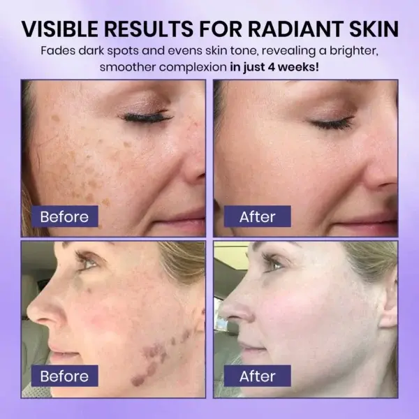 Radiglow Dark Spot Cream - Image 6