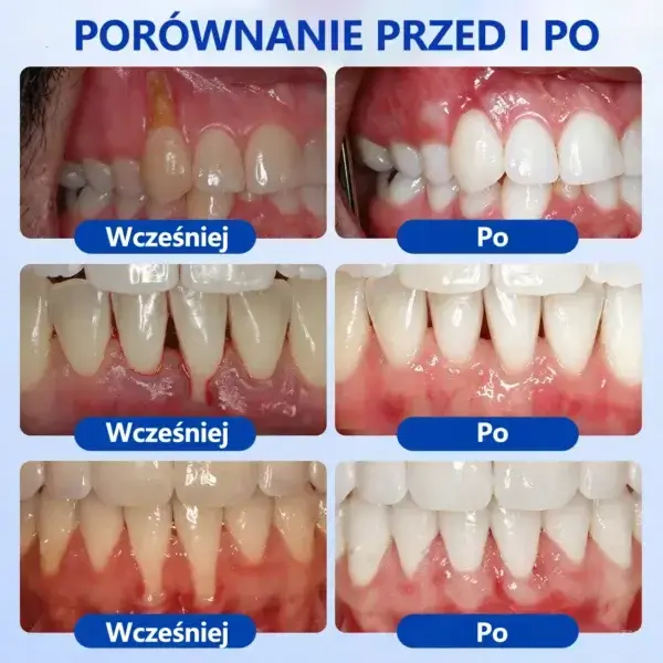 𝑮𝒖𝒎𝑹𝒆𝒗𝒊𝒗𝒆 Ż𝒆𝒍 𝒅𝒐 𝒓𝒆𝒈𝒆𝒏𝒆𝒓𝒂𝒄𝒋𝒊 𝒅𝒛𝒊ą𝒔𝒆ł - Image 9